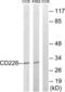 CD226 Molecule antibody, LS-C117845, Lifespan Biosciences, Western Blot image 