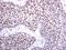 DNA Methyltransferase 3 Beta antibody, GTX129127, GeneTex, Immunohistochemistry paraffin image 