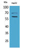 Hexosaminidase Subunit Alpha antibody, STJ96598, St John