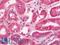 ISG15 Ubiquitin Like Modifier antibody, LS-C211810, Lifespan Biosciences, Immunohistochemistry paraffin image 