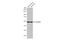 C9orf72-SMCR8 Complex Subunit antibody, GTX635398, GeneTex, Western Blot image 