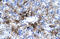 Protein Inhibitor Of Activated STAT 3 antibody, ARP32762_T100, Aviva Systems Biology, Immunohistochemistry paraffin image 