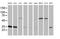 Cytochrome B5 Reductase 3 antibody, MA5-25143, Invitrogen Antibodies, Western Blot image 