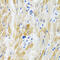 Phosphohistidine Phosphatase 1 antibody, 13-969, ProSci, Immunohistochemistry paraffin image 