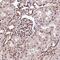 PDS5 Cohesin Associated Factor B antibody, PA5-58824, Invitrogen Antibodies, Immunohistochemistry paraffin image 