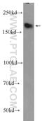 Terminal uridylyltransferase 7 antibody, 25196-1-AP, Proteintech Group, Western Blot image 