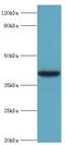 ADH4 antibody, MBS1499152, MyBioSource, Western Blot image 