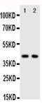C-X-C Motif Chemokine Receptor 5 antibody, PA2021, Boster Biological Technology, Western Blot image 