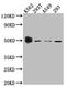 WT1 Transcription Factor antibody, CSB-RA950156A0HU, Cusabio, Western Blot image 