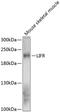 LIF Receptor Subunit Alpha antibody, 14-626, ProSci, Western Blot image 