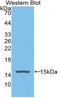 Glutamic--Pyruvic Transaminase antibody, LS-C314162, Lifespan Biosciences, Western Blot image 