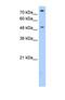 Fc Receptor Like 1 antibody, NBP1-69316, Novus Biologicals, Western Blot image 
