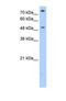 Fc Receptor Like 1 antibody, NBP1-69316, Novus Biologicals, Western Blot image 