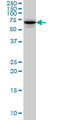 Syntaxin Binding Protein 1 antibody, LS-B5542, Lifespan Biosciences, Western Blot image 