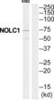 Nucleolar And Coiled-Body Phosphoprotein 1 antibody, abx014680, Abbexa, Western Blot image 