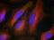 Synaptotagmin 1 antibody, A02314, Boster Biological Technology, Immunofluorescence image 