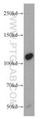 NEDD4 E3 Ubiquitin Protein Ligase antibody, 21698-1-AP, Proteintech Group, Western Blot image 