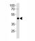 Transcription Factor AP-2 Alpha antibody, F47549-0.4ML, NSJ Bioreagents, Western Blot image 