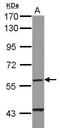 Cytochrome P450 Family 4 Subfamily F Member 11 antibody, GTX116701, GeneTex, Western Blot image 