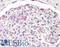 LIM Homeobox Transcription Factor 1 Beta antibody, LS-B8882, Lifespan Biosciences, Immunohistochemistry paraffin image 