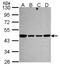NADH:Ubiquinone Oxidoreductase Core Subunit S2 antibody, LS-B10858, Lifespan Biosciences, Western Blot image 