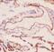 Collagen Type IV Alpha 1 Chain antibody, PB9099, Boster Biological Technology, Immunohistochemistry paraffin image 