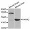 Parkin RBR E3 Ubiquitin Protein Ligase antibody, abx126322, Abbexa, Western Blot image 