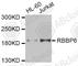RB Binding Protein 6, Ubiquitin Ligase antibody, A6966, ABclonal Technology, Western Blot image 