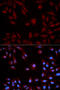 Signal Transducer And Activator Of Transcription 5B antibody, 13-121, ProSci, Immunofluorescence image 