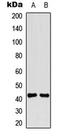 TNF Receptor Superfamily Member 10d antibody, LS-C368638, Lifespan Biosciences, Western Blot image 