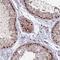 TRNA Methyltransferase 6 antibody, HPA047032, Atlas Antibodies, Immunohistochemistry frozen image 
