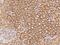 Zinc Finger Protein 232 antibody, 207068-T10, Sino Biological, Immunohistochemistry paraffin image 