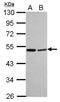 Lactamase Beta antibody, NBP2-15582, Novus Biologicals, Western Blot image 