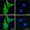 Aldehyde Dehydrogenase 6 Family Member A1 antibody, 42-679, ProSci, Enzyme Linked Immunosorbent Assay image 