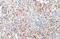 Erk1 antibody, GTX635617, GeneTex, Immunohistochemistry paraffin image 
