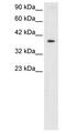 5'-Nucleotidase, Cytosolic IIIA antibody, PA1-24452, Invitrogen Antibodies, Western Blot image 