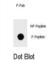 Inhibitor Of Nuclear Factor Kappa B Kinase Subunit Beta antibody, abx032156, Abbexa, Western Blot image 