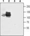 ATPase Sarcoplasmic/Endoplasmic Reticulum Ca2+ Transporting 1 antibody, TA328788, Origene, Western Blot image 