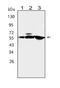 Calcium/Calmodulin Dependent Protein Kinase Kinase 1 antibody, PA1520, Boster Biological Technology, Western Blot image 