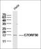 Chromosome 2 Open Reading Frame 72 antibody, orb156039, Biorbyt, Western Blot image 