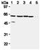 X-Linked Inhibitor Of Apoptosis antibody, ADI-AAM-050-E, Enzo Life Sciences, Western Blot image 