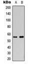 Cytochrome P450 Family 2 Subfamily S Member 1 antibody, MBS8234019, MyBioSource, Western Blot image 