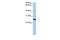 Centrosomal Protein 112 antibody, GTX45452, GeneTex, Western Blot image 