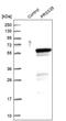 Serine Protease 35 antibody, PA5-58542, Invitrogen Antibodies, Western Blot image 