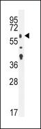 Transforming Growth Factor Beta Receptor 2 antibody, PA5-35076, Invitrogen Antibodies, Western Blot image 