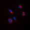 Tyrosinase antibody, LS-C352967, Lifespan Biosciences, Immunofluorescence image 