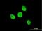 Testis Associated Actin Remodelling Kinase 2 antibody, H00010420-M08, Novus Biologicals, Immunocytochemistry image 