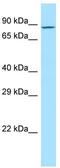 MAM Domain Containing Glycosylphosphatidylinositol Anchor 2 antibody, TA331269, Origene, Western Blot image 