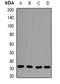 Capping Actin Protein Of Muscle Z-Line Subunit Beta antibody, orb341433, Biorbyt, Western Blot image 