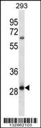 Melanocortin 2 Receptor Accessory Protein 2 antibody, 56-907, ProSci, Western Blot image 